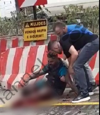 Foto/ “Me gjymtyrë të këputur”, pas shpërthimit të tritolit 27-vjeçari u nxorr i gjallë nga makina