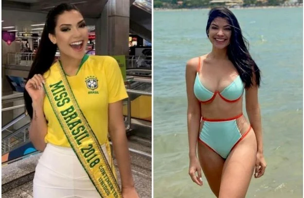 Ish-Miss Brazili vdes në moshën 27 vjeçare nga ataku kardiak pas operacionit në bajame