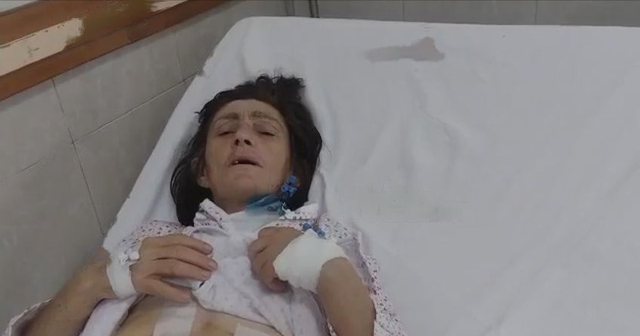 Nusja dhunon barbarisht vjehrrën, 61-vjeçarja humb shpretkën: Më rreh prej 4 vitesh, më duhen miliona lekë për gjak që të jetoj