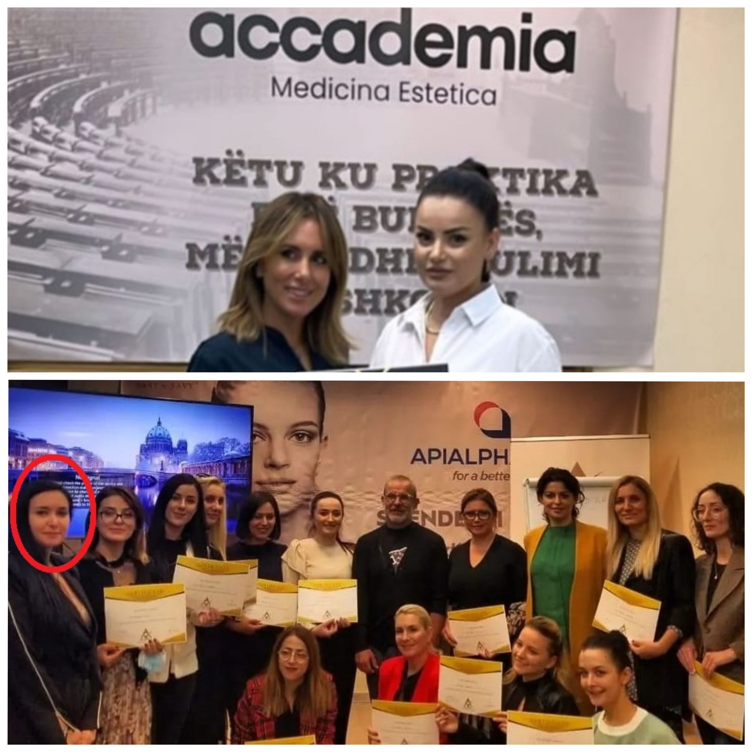 Skandali / Si po pajisen parukieret shqiptare me licenca botoksi nga “akademi” instagrami, në skenë ‘diplomatja’ e Xhaçkës që hiqet si mjeke