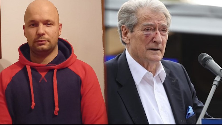 Goditi me grusht Sali Berishën, Gert Shehut i komunikohet masa ‘arrest me burg’ te ‘Trauma’! Do të transferohet në qeli pasi të lërë spitalin