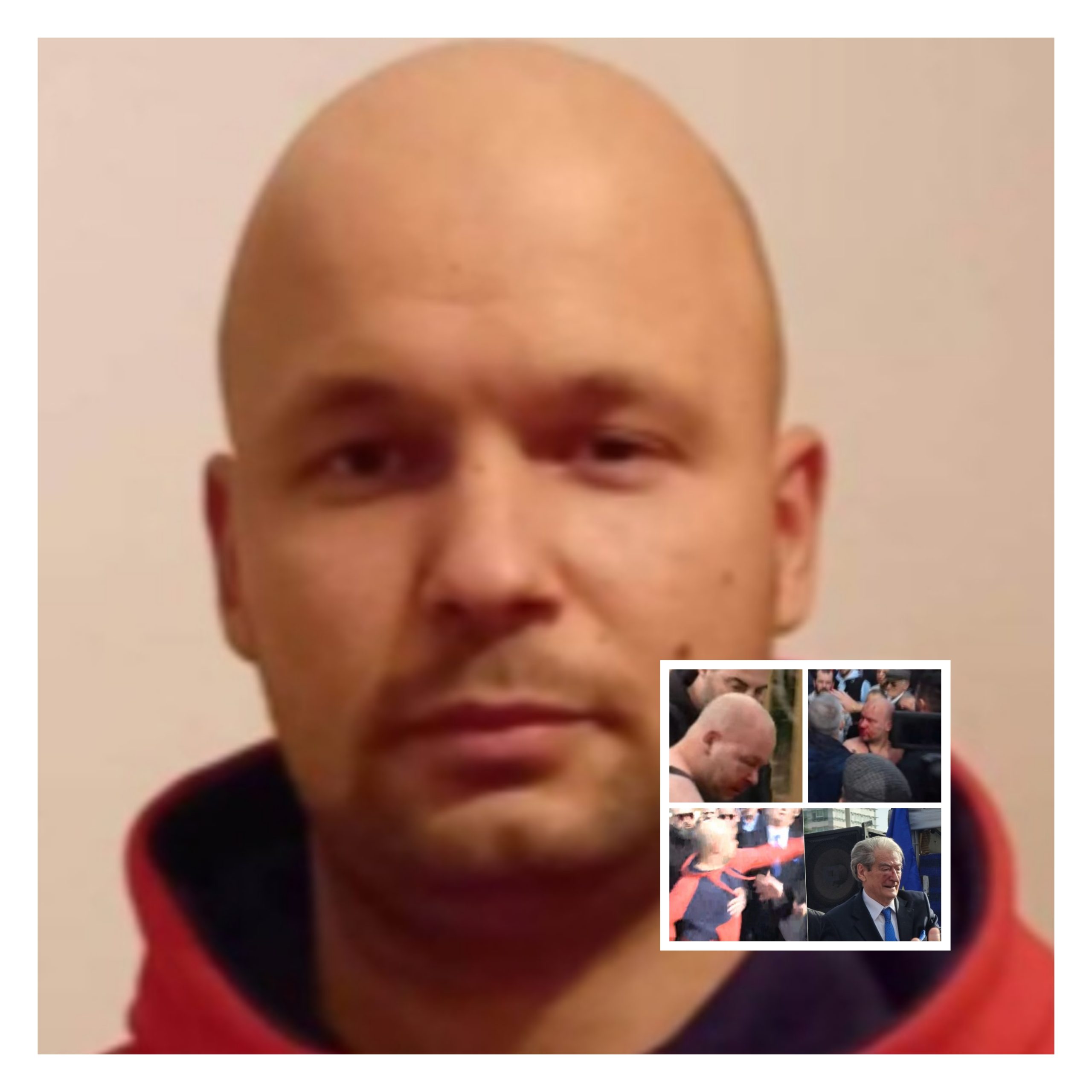 Qëlloi me grusht Berishën dhe u sulmua nga protestuesit/ Gert Shehu me probleme mendore, dërgohet te Trauma