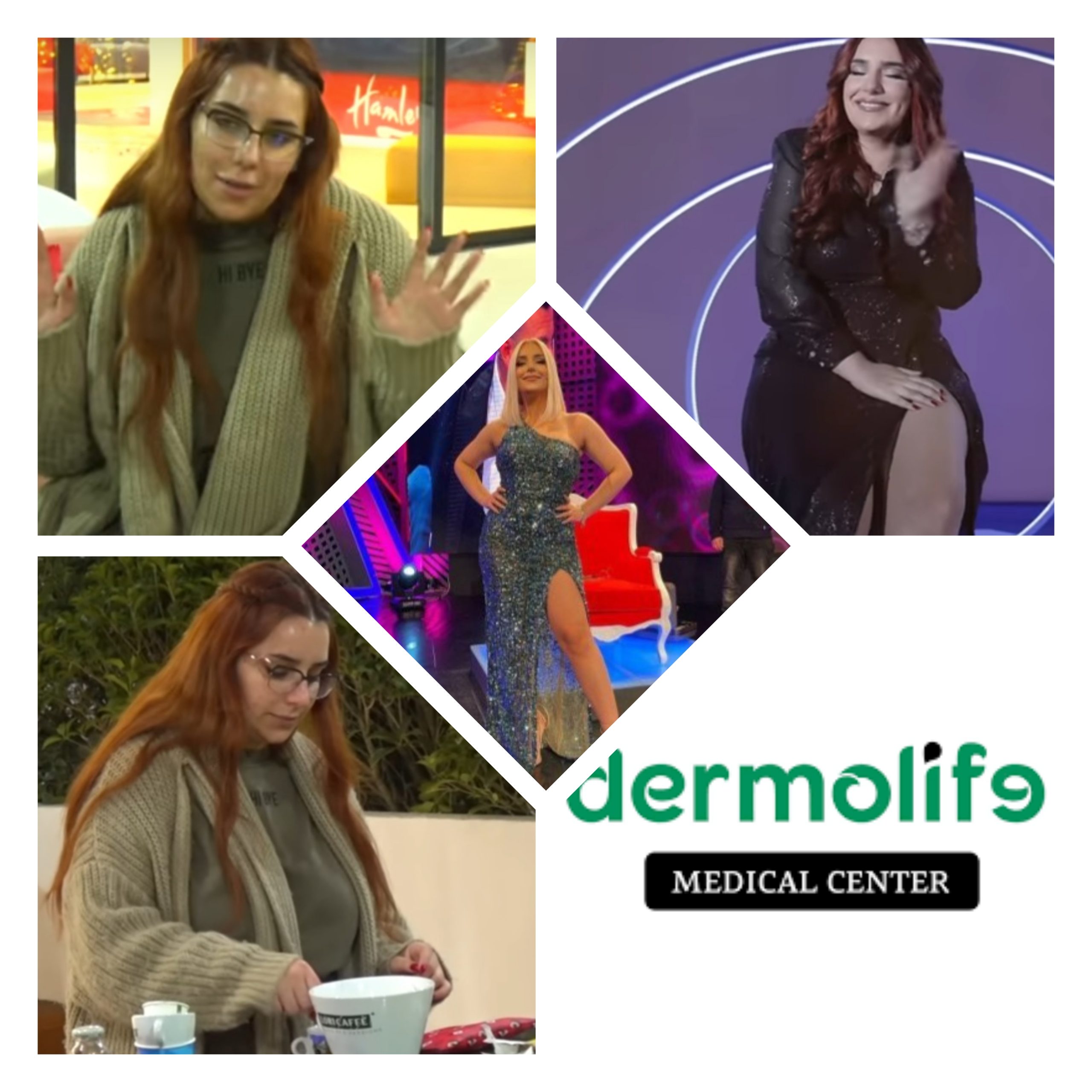 DERMOLIFE mashtrim kriminal me balonin gastrik, ja si Tea Trifoni shtoi në peshë pas ndërhyrjes gjoja të sukseshme. Meridian Ramçaj: Baloni, mashtrim i madh 