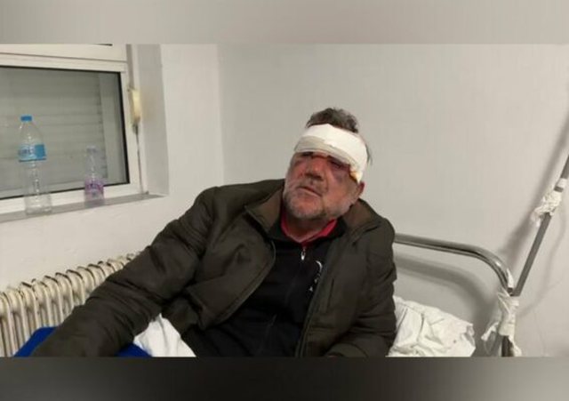 Thellohet skandali, mësuesi i arrestuar për ngacmim seksual është këshilltar i PS në bashkinë e Tërmet Peçit