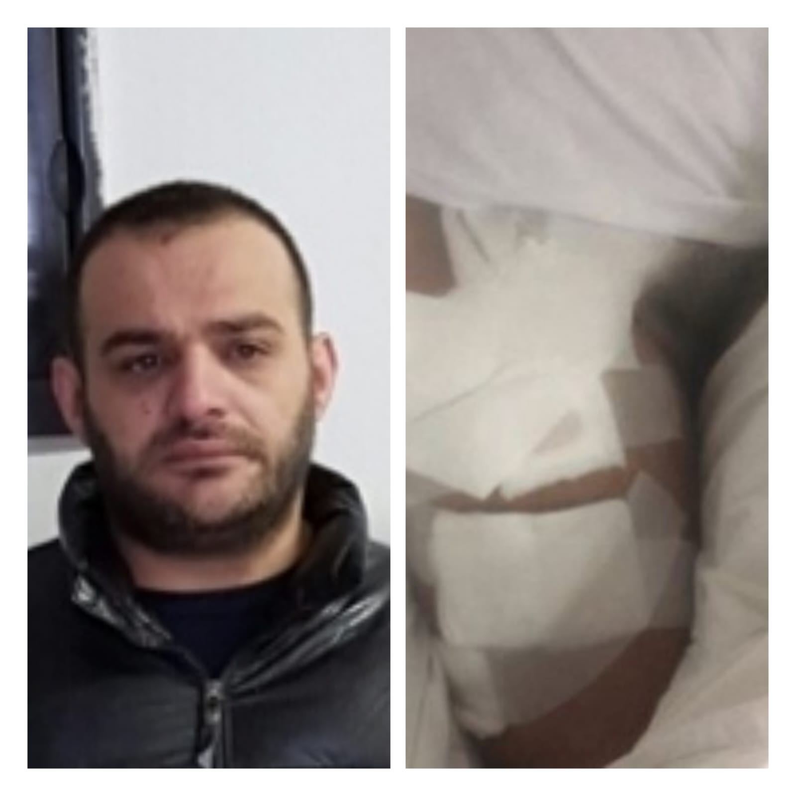 E plagosën 27 herë me thikë në Bllok, Eder Dorzi shfrytëzonte vajzat për prostitucion në Itali, pamjet e 41-vjeçarit