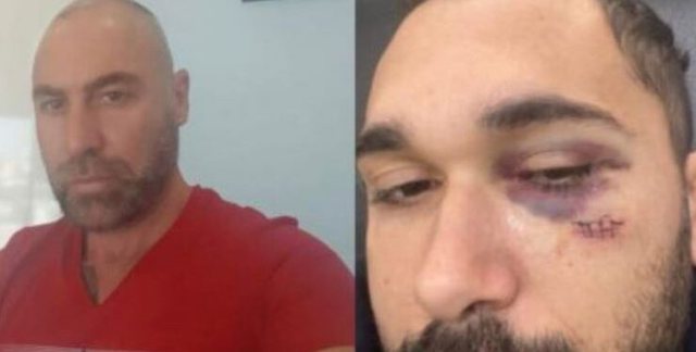 Ish-drejtori i doganës së Fierit shkaktoi 2 aksidente, denoncimi: Më ka goditur edhe mua e është larguar, kishte lidhje me ish-gruan time