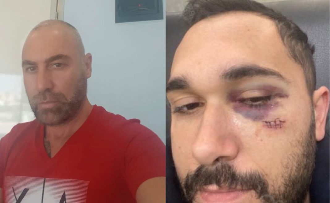 “Të q*** rracën, do të bëj thella–thella”, kush është ish-drejtori i Doganës në Fier që shkaktoi aksidentin në Lungomare