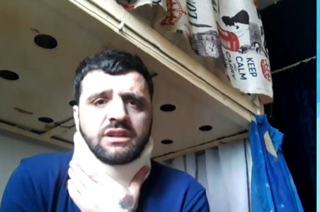 “Mamit i thanë do ta marrësh me arkivol djalin”/ Shqiptari i dhunuar nga policët grekë: S’dua ta shohin fëmijët e mi