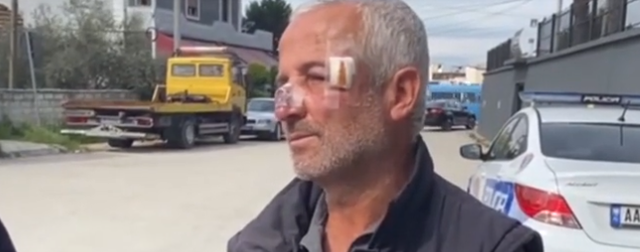 I kërkuan votat e familjes por refuzoi të firmoste formularin! Dhunohet punonjësi i bashkisë Patos, dëshmia: Më goditi përgjegjësi
