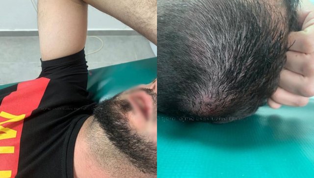 Pamje të rënda/ Tre përfaqësues të PS-së qëllojnë me qyta pistoletash aktivistët e PD-së
