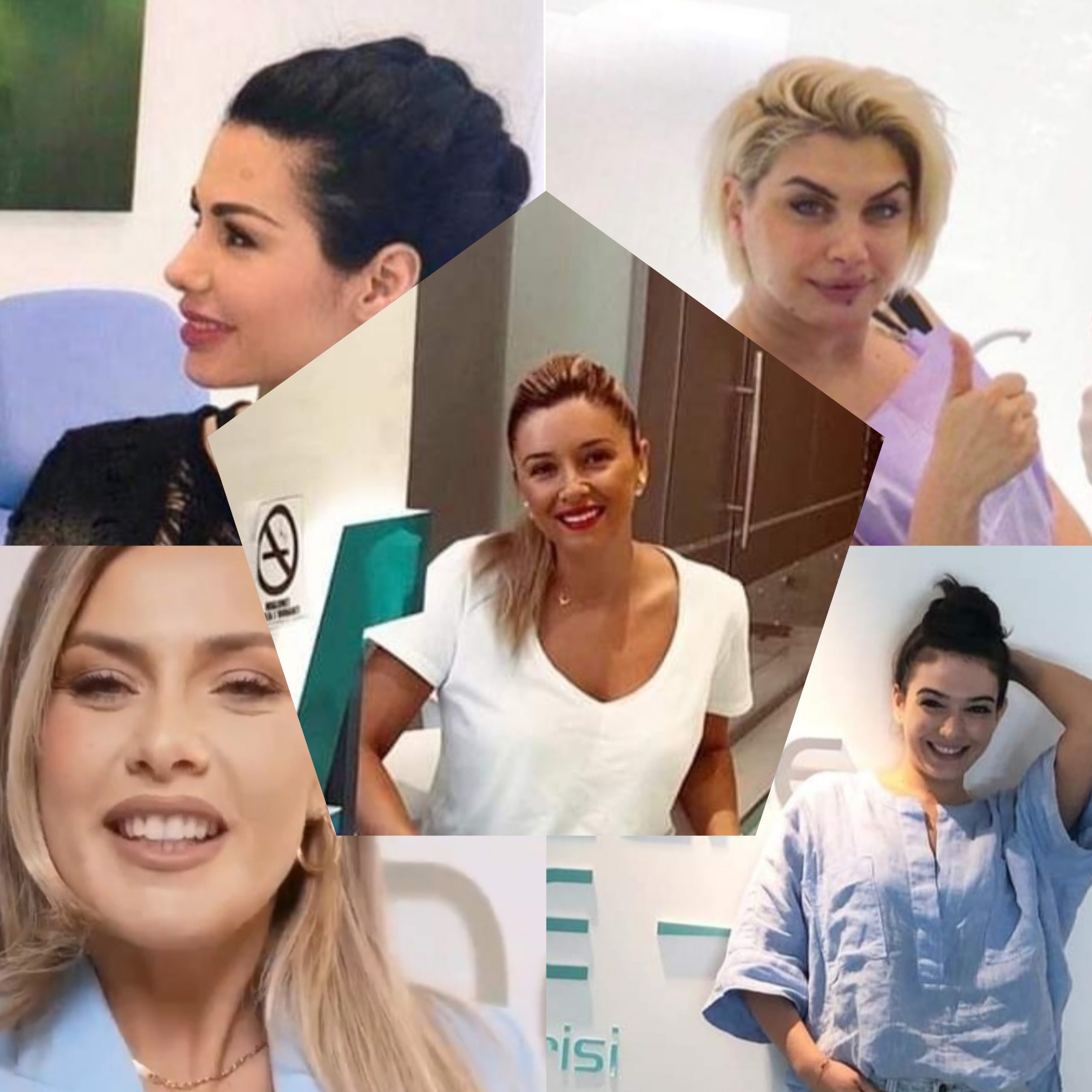 Çiljeta, Olta Gixhari, Malaj dhe Alketa Vejsiu të përfshira në pastrim parash? Reklamuan lavatriçen DentalCare One që punonte në të zezë, 540 mijë euro nga parajsat fiskale