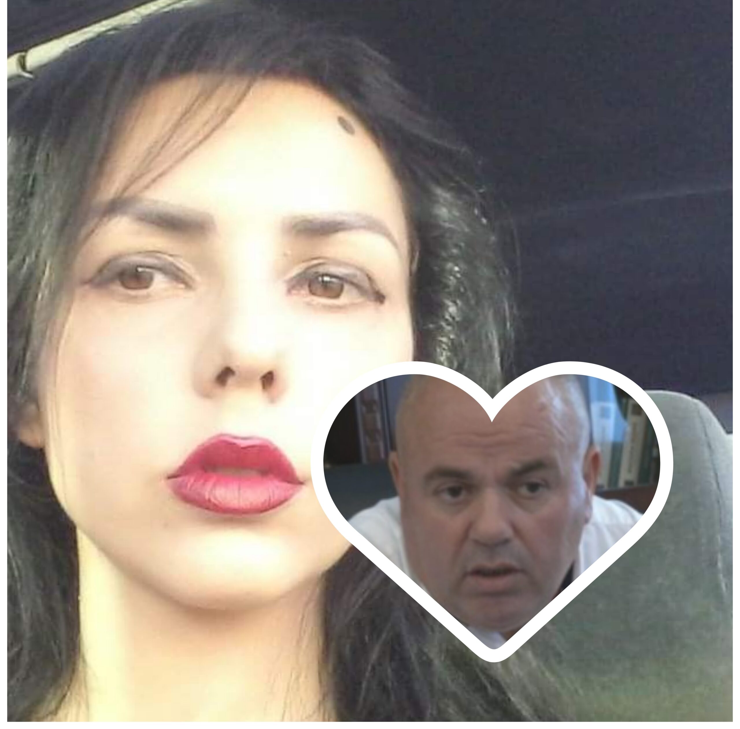 Ekskluzive / Alma Kaçi bëri ndërhyrje estetike me paratë e Gjicit në klinika të shtrenjta, burrin e ndau disa muaj më parë. Ku i mori lekët që bëri buzët që çmendën Safet hamshorin?
