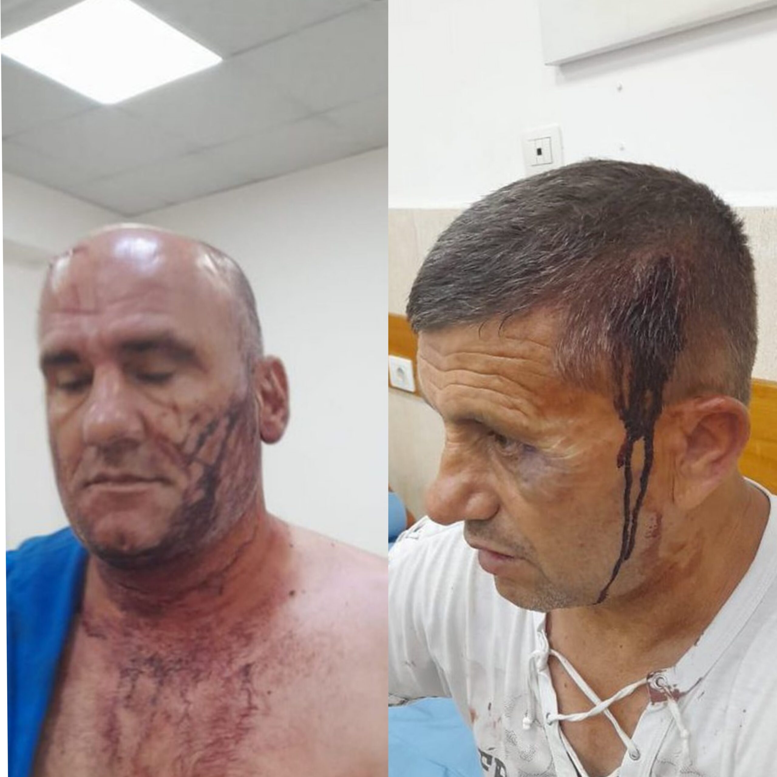 Pamjet e të dhunuarve nga fisi Rraja, barbaria për guroren e Përparim Rrajës, minat po shembin shtëpitë