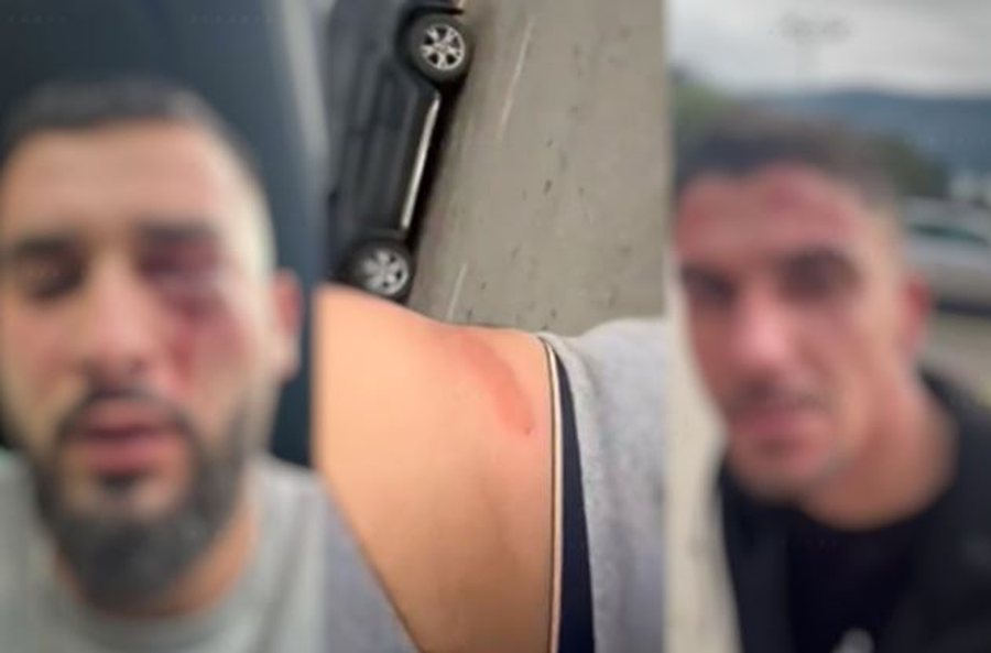 Dhuna ndaj shqiptarëve në Malin e Zi, në pranga edhe 3 të tjerë