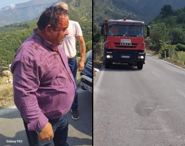 E rëndë në Dukat / I kapi duke gërmuar në tokën e tij, punonjësit e firmës “Gjikuria” masakrojnë banorin