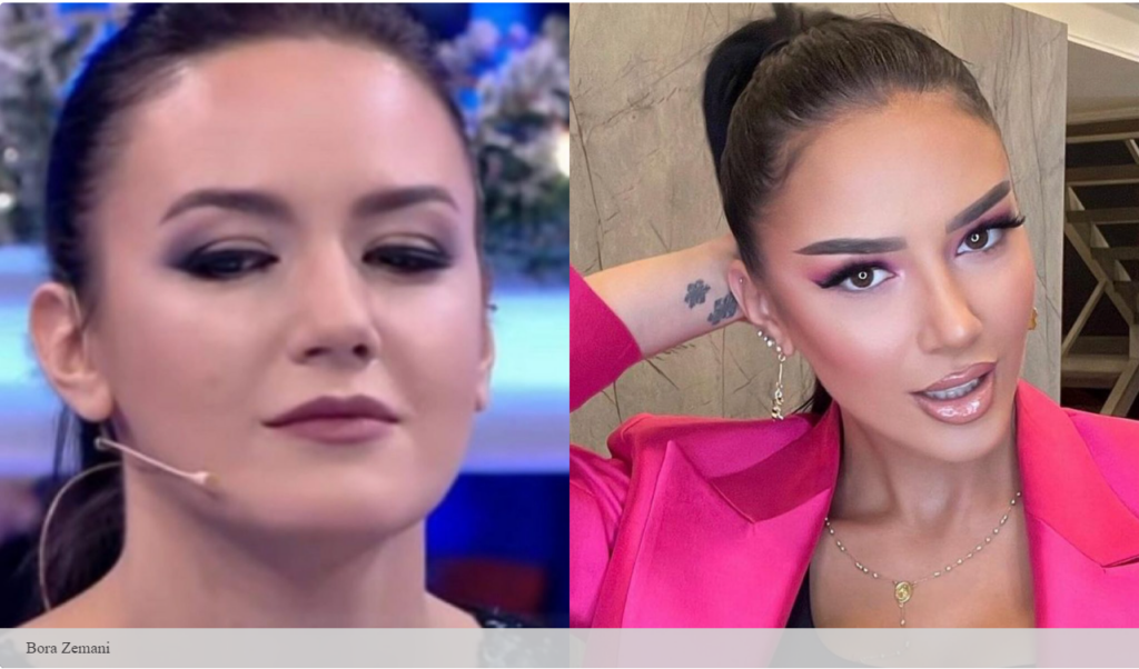 Bora Zemani mohon se ka bërë ndërhyrje estetike: Fakti që unë nuk kam bërë operacione plastike, nuk do të thotë që jam e lumtur me veten