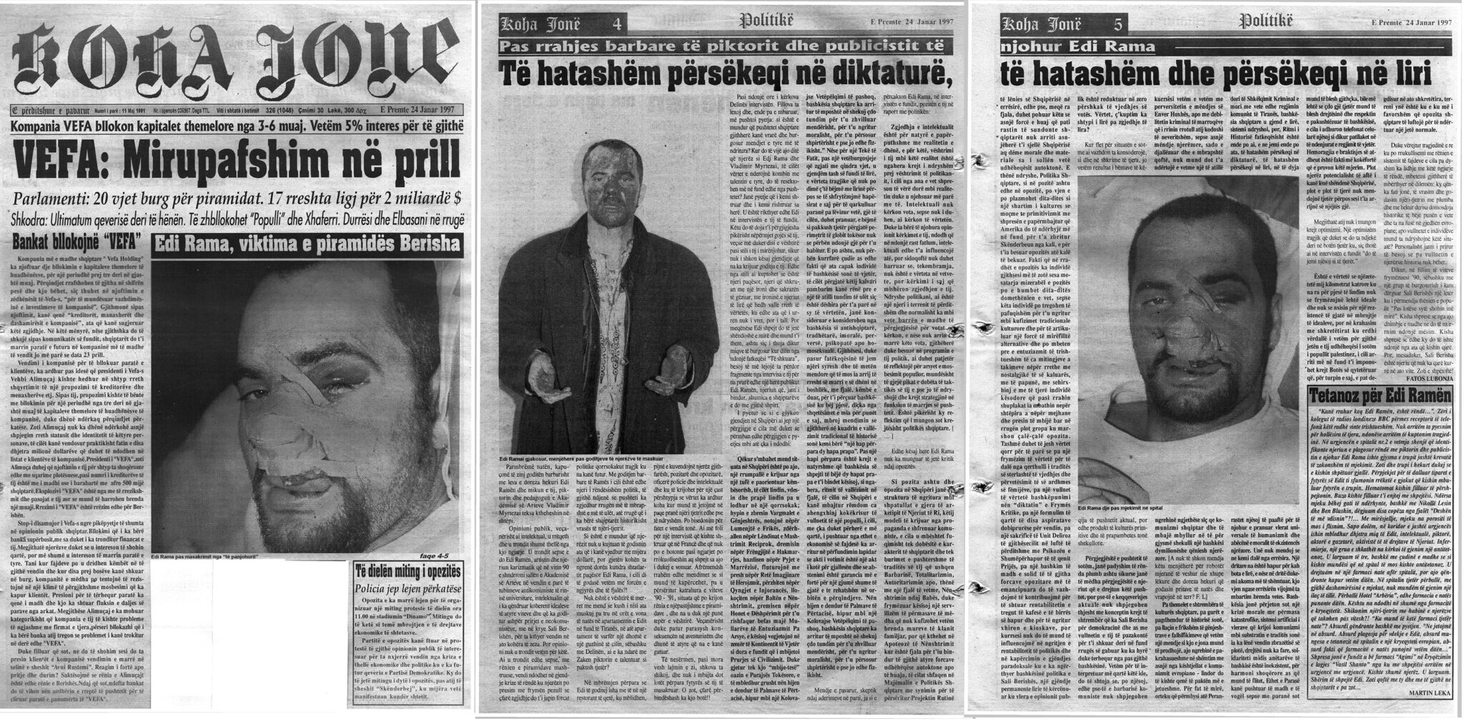 “Mos i jepni ilaç, le të vdesë” – Nikoll Lesi: Çfarë i thoshin agjentët e SHIK-ut mjekëve, pasi u rrah Edi Rama në ‘97
