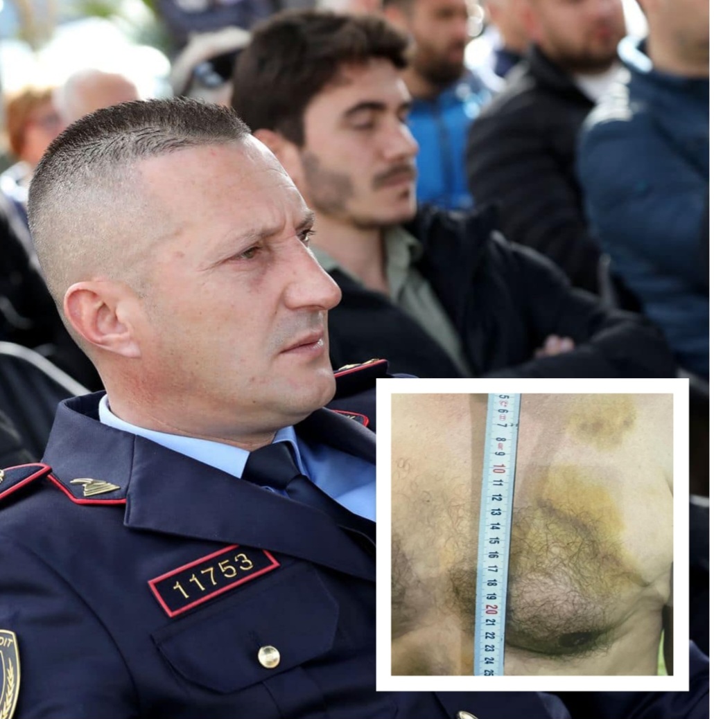 Nëndrejtori i Policisë Vlorë Klodian Kondi mbulon ndërtimet pa leje të mafiozit Kol Noku, dhunoi një qytetar