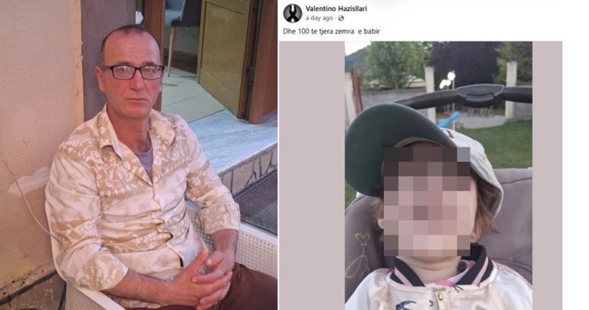 Sot në terapi intensive pas djegieve të rënda në trup, dy ditë më parë 6-vjeçarja festoi ditëlindjen