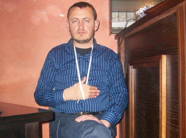 Pse s’u paraqit Berisha për 21 janarin? Ja shpjegimi i gazetarit të plagosur nga Garda!