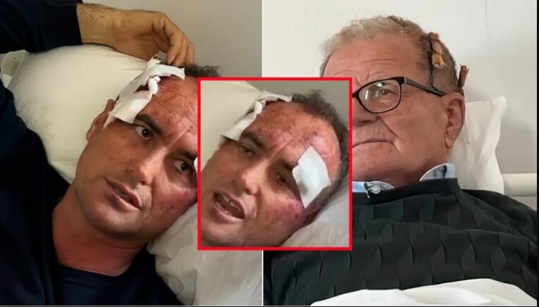 Efektivi i policisë së Fierit bën për spital babë e bir! 46-vjeçari: I bëra koment motrës së tij në Facebook, i thashë vetëm ‘je shumë e bukur’