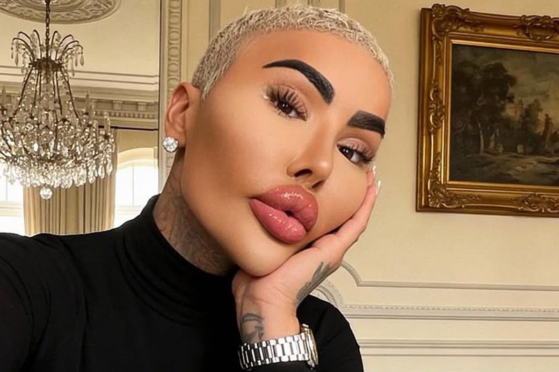 I njohur për ndërhyrjet e shumta në fytyrë, vdekja misterioze e influencerit të njohur