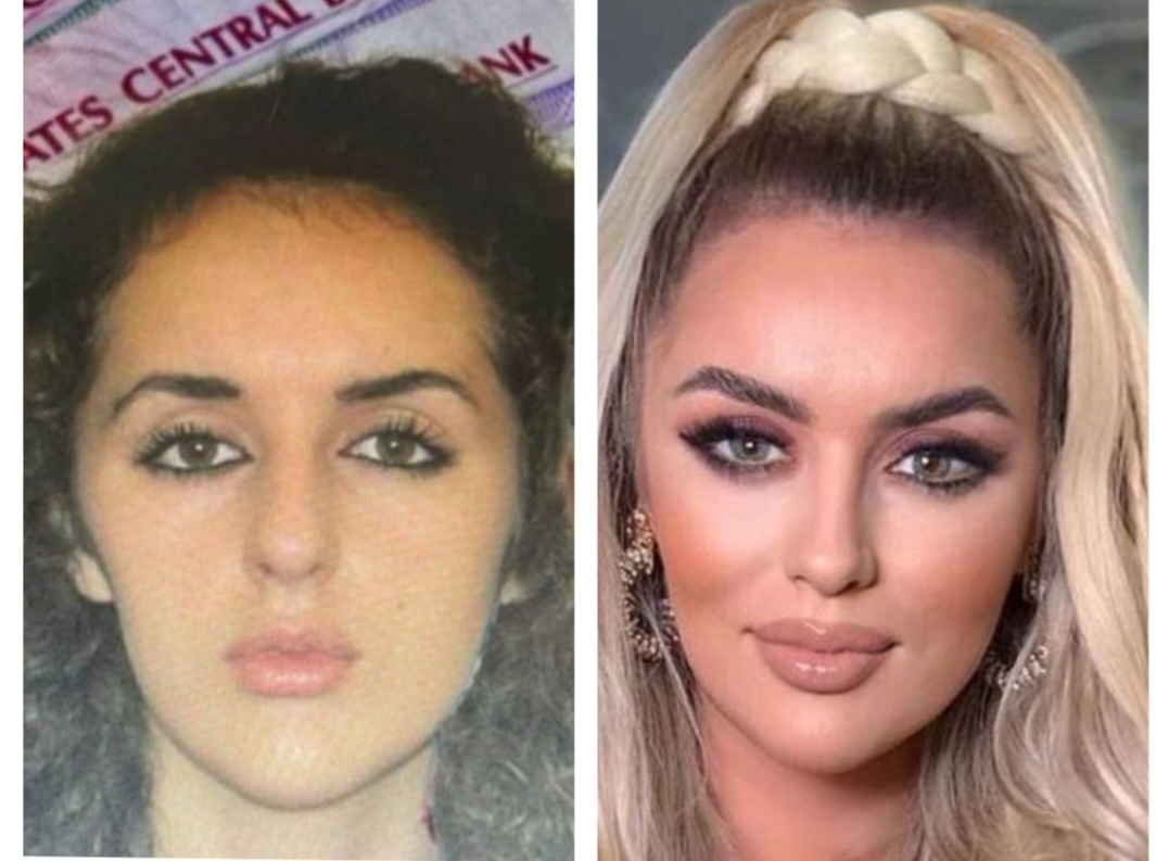 Historia e motrave Berishaj, ndryshimi pas operacioneve plastike dhe sherri me Klea Prengën për P Diddy’s nga Fushë Arrësi