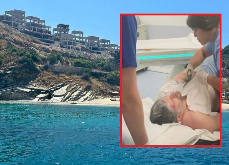 Grushte e shkelma/ “Pika e voçkël” e Kumbaros fut në sherr ortakët e ‘Finman’, Idajet Ismailaj bën për spital Sokol Agalliun