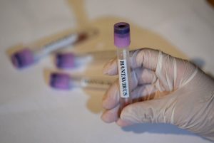 Hantavirusi, eksperti i shëndetit publik tregon kategoritë e personave të rrezikuar