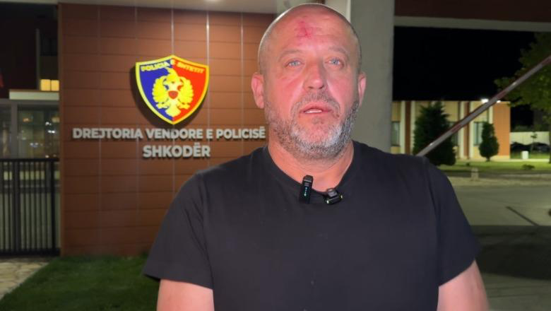 Dhunoi gazetarin Ervin Dushi bashkë me 2 persona të tjerë, arrestohet 51-vjeçari në Shkodër