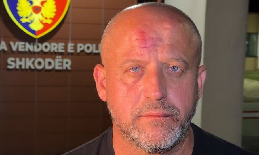Dhunoi gazetarin Ervin Dushi, pronari i “Xhedis” mohon akuzat: Nuk e godita, vetëm e shtyva