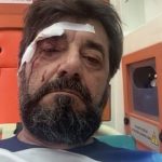 Dhunohet barbarisht gazetari Ilir Demaliaj, dyshohet për porosi nga klanet e krimit dhe korrupsionit