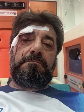 Dhunohet barbarisht gazetari Ilir Demaliaj, dyshohet për porosi nga klanet e krimit dhe korrupsionit
