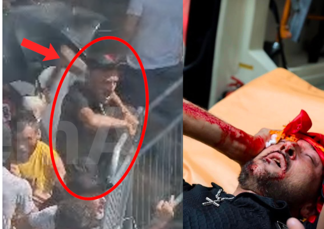 Video rrëzon pretendimin, protestuesi i paraqitur si i dhunuar nga policia u godit nga grupi i tij