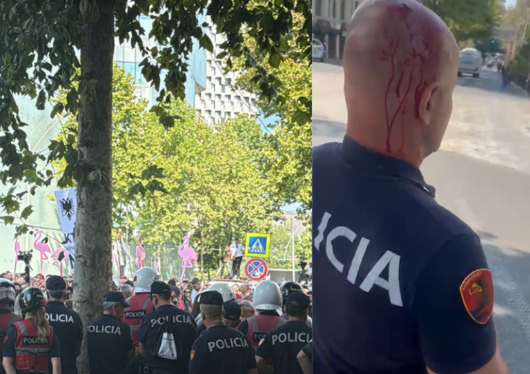 Polici i gjakosur nga gurët e protestuesve, Balla: Kjo nuk është më protestë paqësore, është terrorizëm